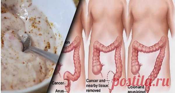 Эти два ингредиента выведут из толстой кишки килограммы токсинов!