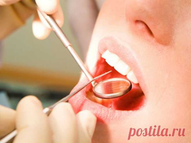Мифы и правда о кариесе
