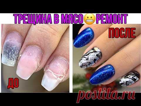 Почему сломался ноготь?😱Коррекция после другого мастера💅Последствия неправильной архитектуры😱 - YouTube