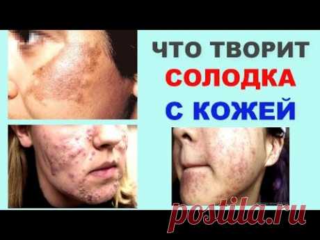 ЧТО творит СОЛОДКА с КОЖЕЙ ?
