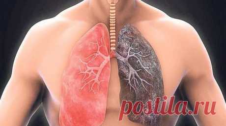 Мифы и правда о хронической обструктивной болезни легких | Рецепты здоровья мира | Дзен