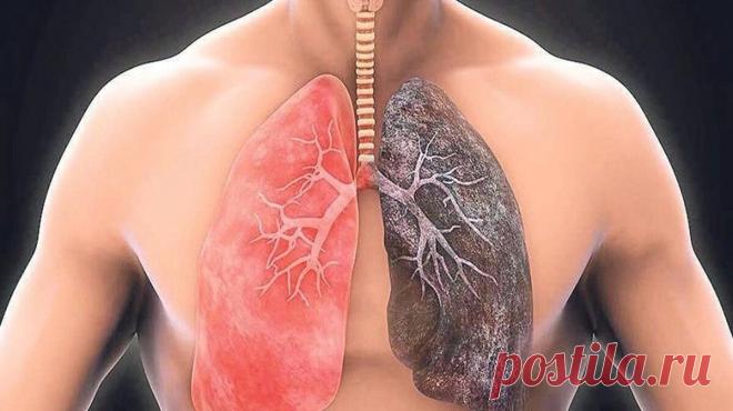 Мифы и правда о хронической обструктивной болезни легких | Рецепты здоровья мира | Дзен