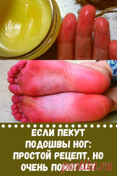 Предлагаю простой и действенный рецепт, если «горят» подошвы ног. По крайней мере мне он помог.