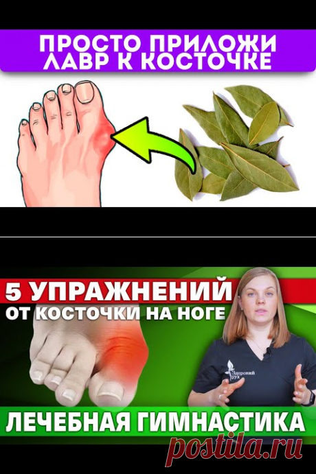 Избежал операции на ноге! Косточка на ноге рассосалась сразу после…Записывайте рецепт! - YouTube
