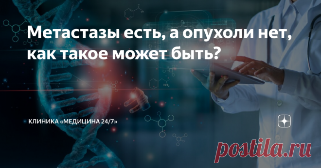 Метастазы есть, а опухоли нет, как такое может быть? Метастазов без первичной опухоли быть не может. Тем не менее, примерно в 5% случаев метастатический рак обнаруживается, а его первичный очаг нет. Как такое может быть?