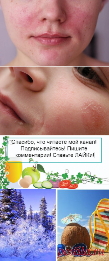 Врач дал неожиданный совет, как справиться с проблемной кожей у подростка
Здравствуйте, уважаемые читатели! Когда нашей внучке исполнилось 4 года, дерматолог со вздохом вычеркнула из нашей карты диагноз « атопический дерматит «. Фото из открытых источников Мы долго тогда обсуждали с врачом, какие причины могли спровоцировать развитие этого недуга у ребенка, и пришли к следующим выводам: 1. Еще в роддоме девочку начали подкармливать одной из известных […]
Читай дальше на сайте. Жми подробнее ➡