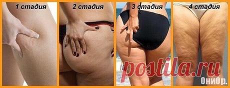 (20) Одноклассники