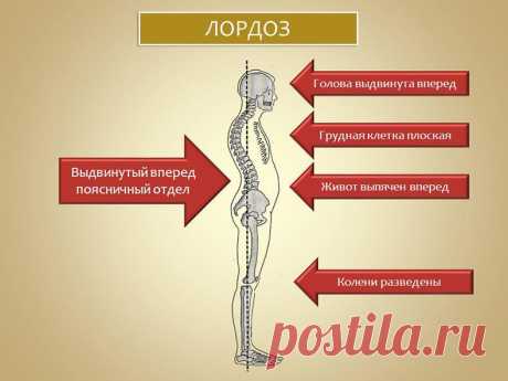 Упражнения устранения дефектов костно-мышечной системы и для правильной осанки Упражнения наиболее полезны тем, кто занят сидячей работой, способствующей развитию сутулости (школьники, студенты). Занимайтесь регулярно и вы скоро почувствуете, что спина ваша выпрямляется, поднимая грудную клетку, осанка улучшается, походка становится упругой и грациозной.