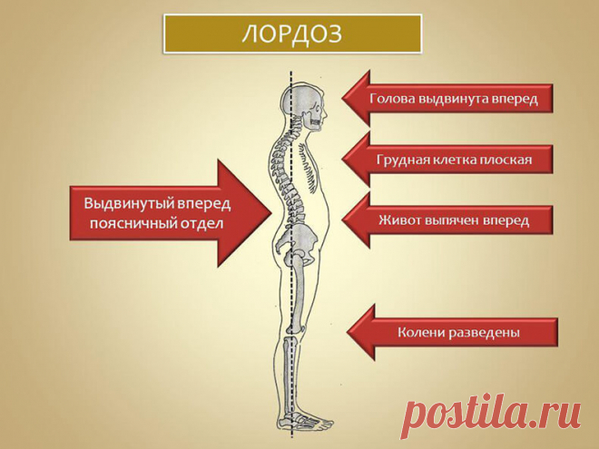Упражнения устранения дефектов костно-мышечной системы и для правильной осанки Упражнения наиболее полезны тем, кто занят сидячей работой, способствующей развитию сутулости (школьники, студенты). Занимайтесь регулярно и вы скоро почувствуете, что спина ваша выпрямляется, поднимая грудную клетку, осанка улучшается, походка становится упругой и грациозной.