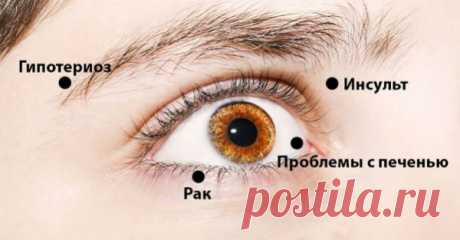 Запомните эти 8 сигналов, которые подают тебе твои же глаза. И никогда не болейте!!!