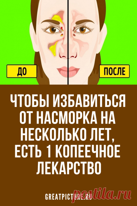 Чтобы избавиться от насморка на несколько лет, есть 1 копеечное лекарство Этот простой и дешевый рецепт способен избавить от неприятных симптомов надолго.Все гениальное просто, и этот способ может избавить даже от хронического насморка и не запущенного гайморита (в комплексе).   #красота  #самоеинтересное  #советы #здоровье
