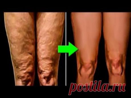 Вы не поверите чем ОНА намазала Свою КОЖУ. Это Есть у Каждого, но никто ЭТО не использует...