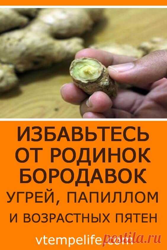 Избавьтесь от родинок, бородавок, угрей, папиллом и возрастных пятен | В темпі життя