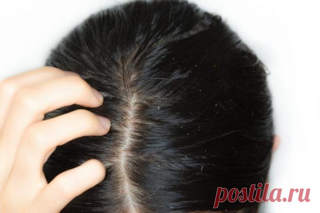 Эфирные масла для ухода за жирными волосами