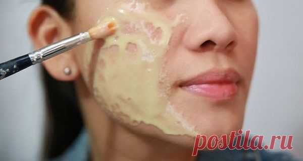 Uklonite tamne fleke sa lica: Za par dana imaćete kožu kao beba! (RECEPT) – Narodni Recepti