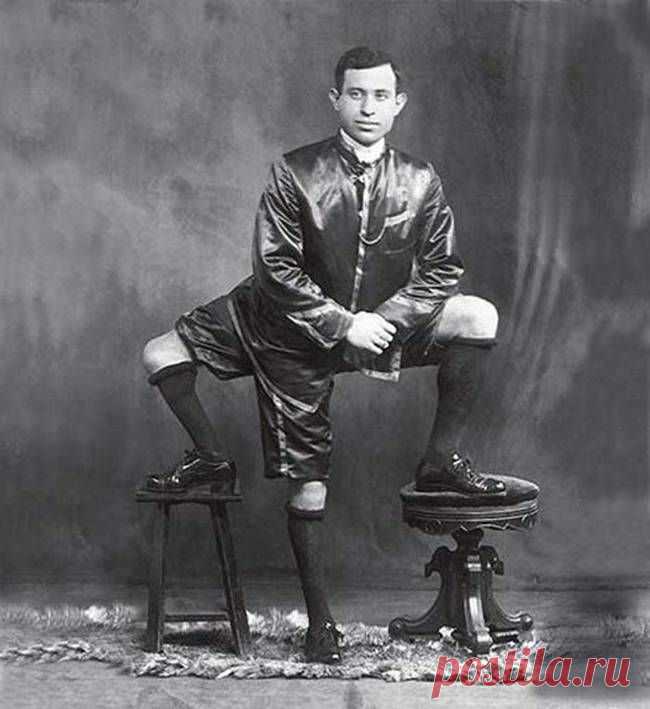 Трудно поверить, но эти 5 человек с аномалиями действительно существовали! Их истории невероятны...