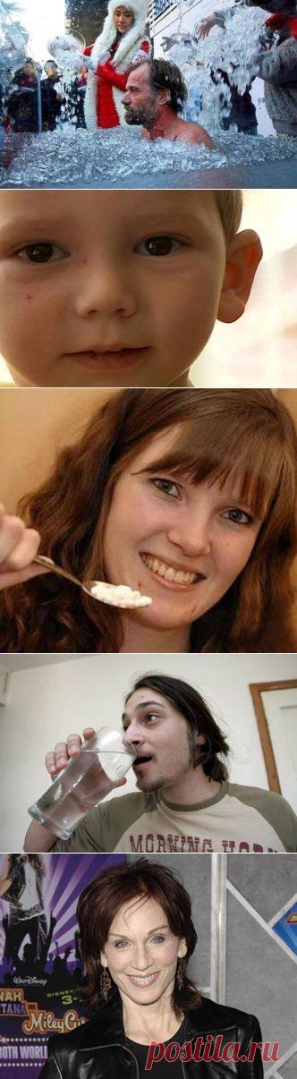 Люди с самыми необычными отклонениями от нормы | ВСЕГДА В ФОРМЕ!