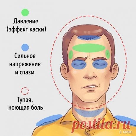 5 типов головной боли и способы быстро от них избавиться