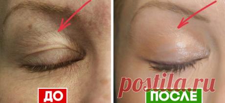 Как вернуть молодость коже век: 5 проверенных средств, которые не дадут тебе лечь под нож.
Модели томным пронзительным взглядом взирают на нас со страниц каталога косметики. Сразу...
Читай пост далее на сайте. Жми ⏫ссылку выше