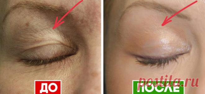 Как вернуть молодость коже век: 5 проверенных средств, которые не дадут тебе лечь под нож.
Модели томным пронзительным взглядом взирают на нас со страниц каталога косметики. Сразу...
Читай пост далее на сайте. Жми ⏫ссылку выше