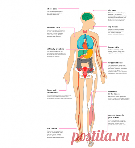 Добавки, позволяющие устранить воспалительные процессы Фактором воспалительного процесса в организме может оказаться стресс, болезнь, травма. Но воспаление также вызывают порочное питание и нездоровый образ жизни. Чтобы устранить воспаление, специалисты советуют прием специализированных добавок в комплексе с другими оздоровительными мерами.