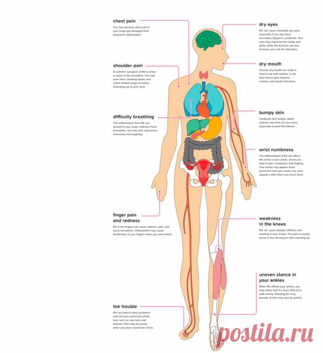 Добавки, позволяющие устранить воспалительные процессы Фактором воспалительного процесса в организме может оказаться стресс, болезнь, травма. Но воспаление также вызывают порочное питание и нездоровый образ жизни. Чтобы устранить воспаление, специалисты советуют прием специализированных добавок в комплексе с другими оздоровительными мерами.