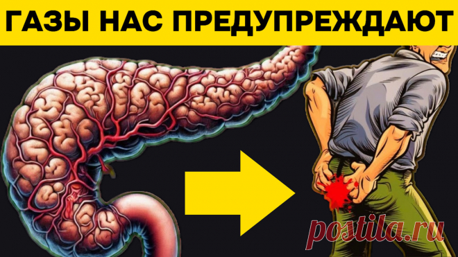 10 тревожных признаков рака поджелудочной железы, которые требуют внимания со стороны врачей | Игорь Ботоговский | Дзен