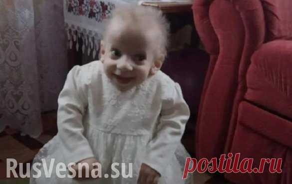 На Украине восьмилетняя девочка умерла от старости В Луцке скончалась восьмилетняя девочка из-за редкой болезни, которая провоцировала ускоренное старение. Об этом сообщил директор Волынской областной