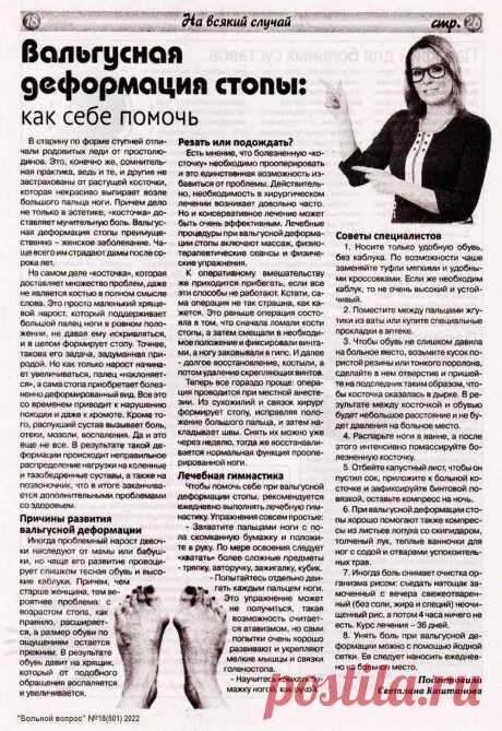 Вальгусная деформация стопы