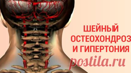 90 % трудоспособного населения страдает от шейного остеохондроза… Останови этот замкнутый круг! — Полезные советы