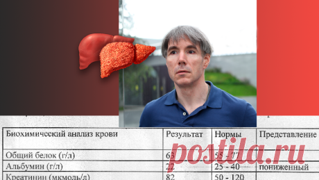Как быстро проверить больна ли ваша печень | Алексей Гордовский | Яндекс Дзен