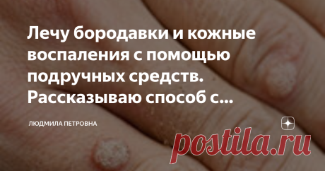 Лечу бородавки и кожные воспаления с помощью подручных средств. Рассказываю способ с касторовым маслом и содой Здравствуйте! Снова и снова возвращаюсь к средствам народной медицине. Всеми нами забытое Касторовое масло, помните мультфильмы 60-70 годов, где персонажи мультиков лечили так называемой в народе Касторкой. Вот эта самая Касторка широко применялась в лечении множества болезней в 60-70 годы. В наше время, когда наша медицина далеко шагнула вперед по производству ме...