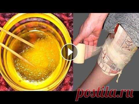 Эти 2 рецепта для СУСТАВОВ творят ЧУДЕСА/ Вытянет всю боль из КОЛЕН, СПИНЫ, ШЕИ Хотите НЕ знать, что такое 