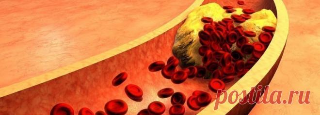 Холестериновая смерть: ученые назвали самые опасные продукты | Волковыск.BY