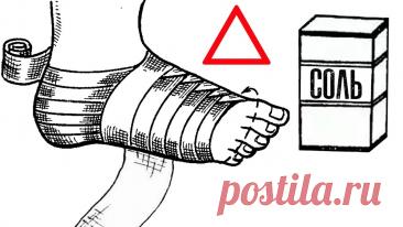 Солевые повязки: старинный метод, который помогает при болях, отёках и воспалениях — без таблеток и уколов | Советы для здоровья | Дзен