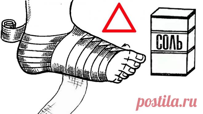 Солевые повязки: старинный метод, который помогает при болях, отёках и воспалениях — без таблеток и уколов | Советы для здоровья | Дзен
