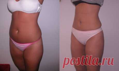 Многие полные девушки считают - добиться плоского животика невыполнимая задача! Я же уверенна в обратном!

Советую вам попробовать данный способ - вы сможете сбросить до 5 килограмм лишнего веса и похвастаться животиком без жира.