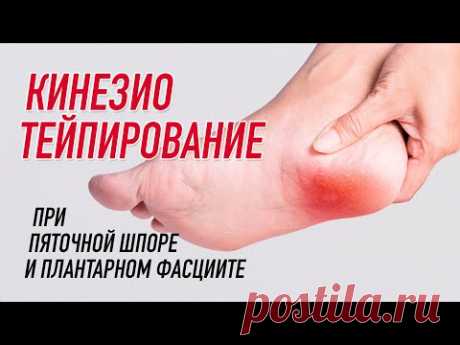 ✅ КИНЕЗИОТЕЙПИРОВАНИЕ ПРИ ПЯТОЧНОЙ ШПОРЕ | Сания Абдрахманова | Учебный центр BBALANCE