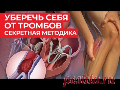 Тромбоз больше не страшен! / Народная профилактика тромбоза