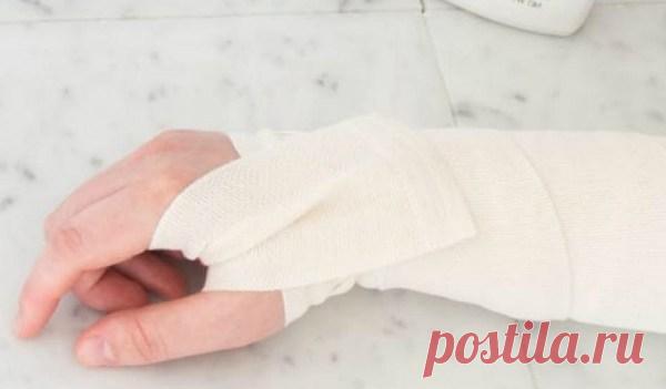 Она намазала руку зубной пастой и перевязала… Наутро результат приятно удивил!