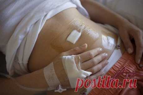 Аппендицит: признаки и симптомы / Будьте здоровы