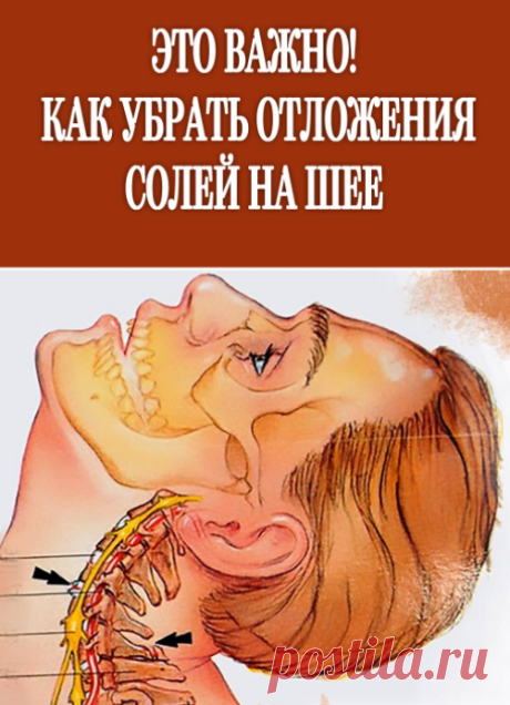 Как бороться с отложением солей в шее