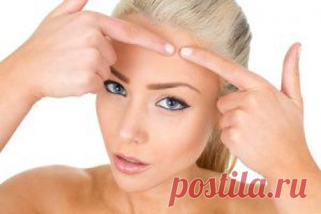 Что делать, если выдавила прыщ? | LadyFor