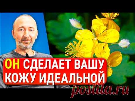 ОН лечит любые кожные болезни: папилломы, бородавки, грибок, герпес, экземы и..! Забытые рецепты.