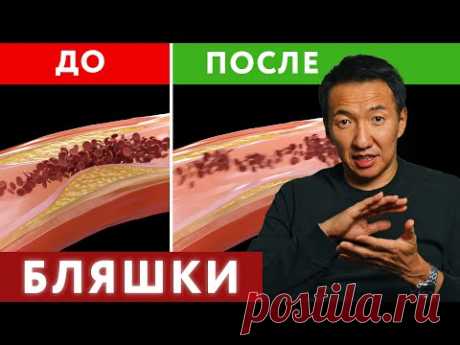 Это поможет в профилактике БЛЯШЕК В СОСУДАХ? #докторжимба