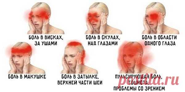 О чем говорит боль в разных частях головы?