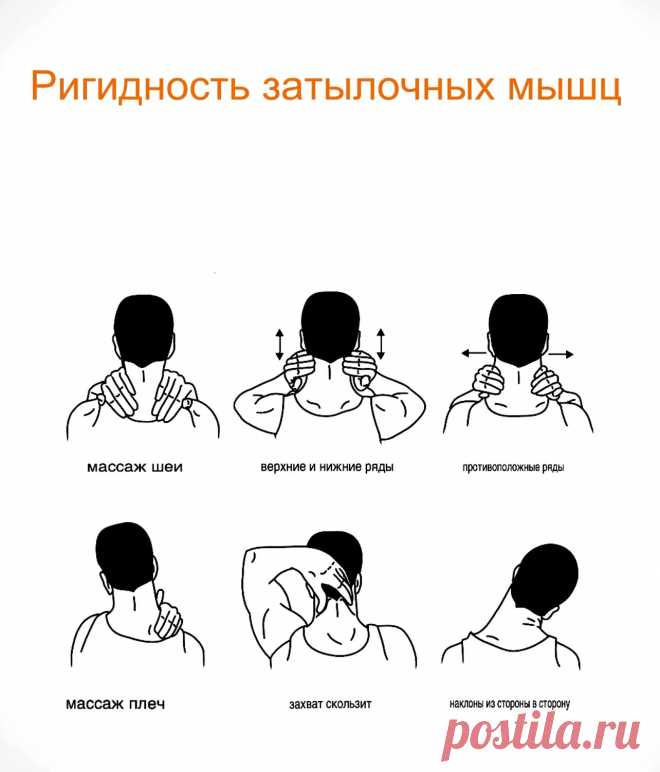 Скованность в шее. Триггерные точки