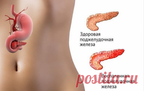 Если Беспокоит Поджелудочная Железа, то Нужно...