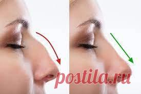 Нос с горбинкой  (код МКБ-10; код МКБ-11): описание, причины, симптомы, как лечить | Клиника лечения боли: врачи онлайн