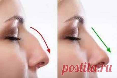 Нос с горбинкой  (код МКБ-10; код МКБ-11): описание, причины, симптомы, как лечить | Клиника лечения боли: врачи онлайн